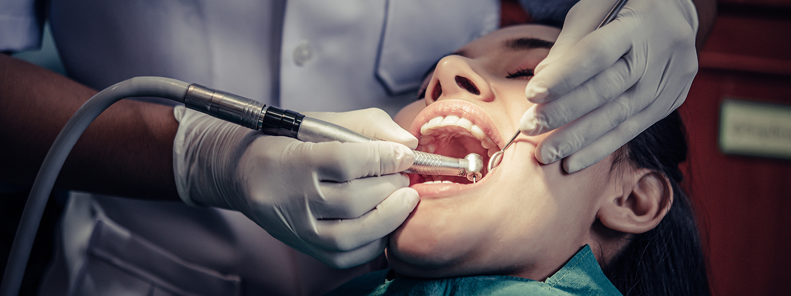 Dental Bonding: A Complete Guide and Explanation